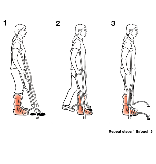 Step-by-Step: Using Crutches With Step To (Weight Bearing) | Community ...