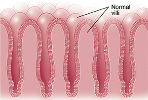 Closeup cross section of normal intestinal villi.